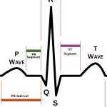 Normal ECG and Heart Rate calculation